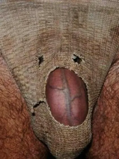 when the stink lures you like a moth to a flame