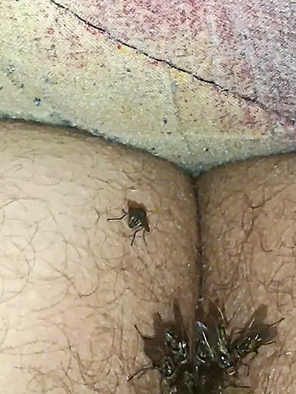 Flies on my anus in the village.  06. 2025