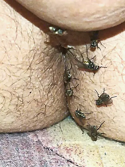Flies on my anus in the village.  06. 2025
