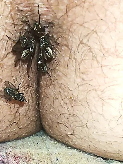 Flies on my anus in the village.  06. 2025