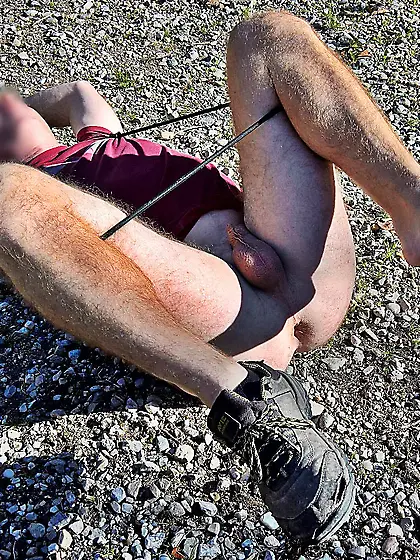 Andy sedated Gymnast 76