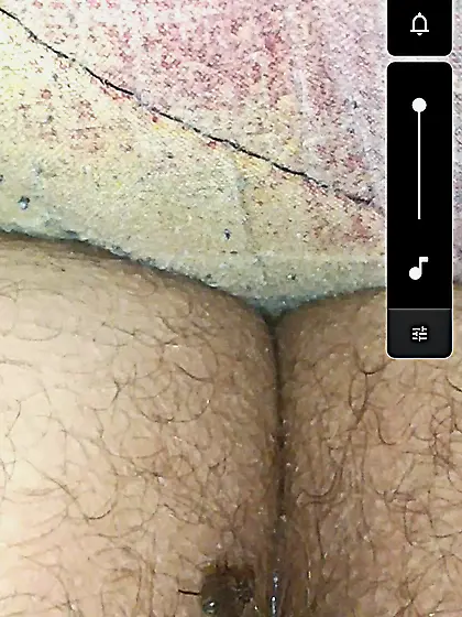 Flies on my anus in the village.  06. 2025