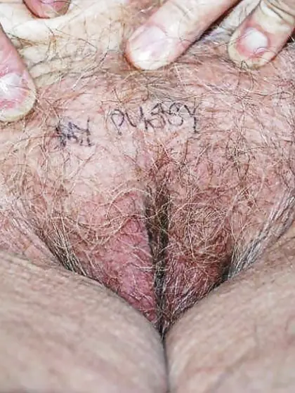 Old ugly holes!