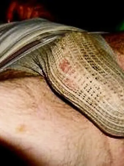 when the stink lures you like a moth to a flame