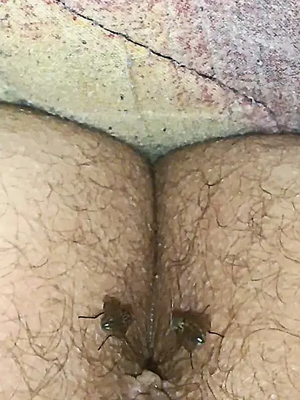 Flies on my anus in the village.  06. 2025