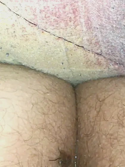 Flies on my anus in the village.  06. 2025