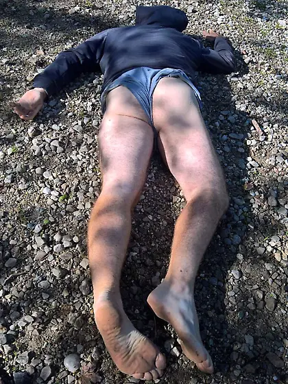 Andy sedated Gymnast 11