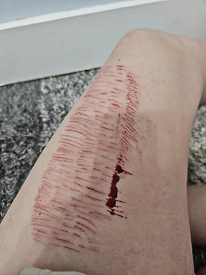 Cute 18 year old with cuts