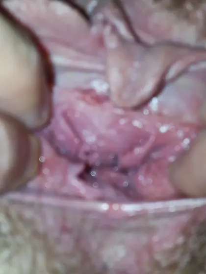 Big Pussy Lips Huge Labia Large Vagina