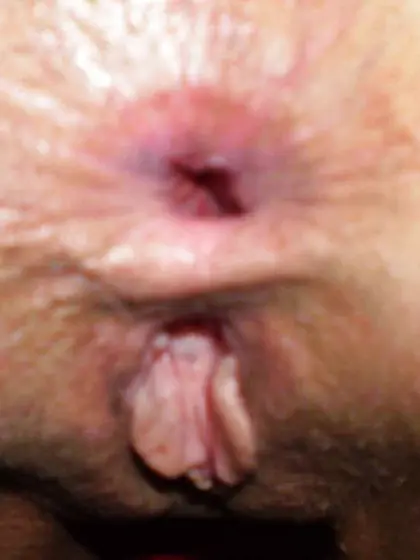 Today free6 pictures