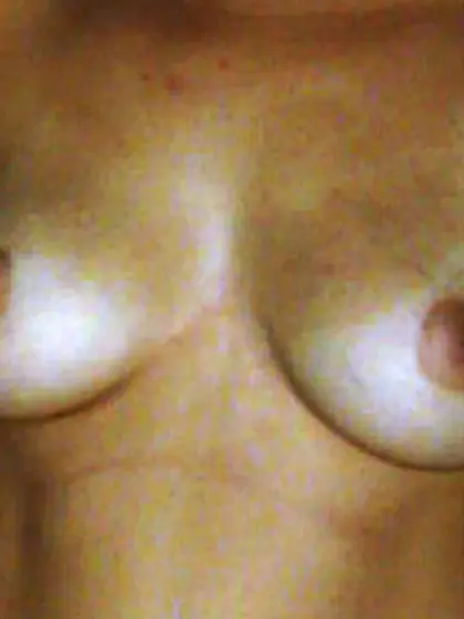 mis tetas peludas