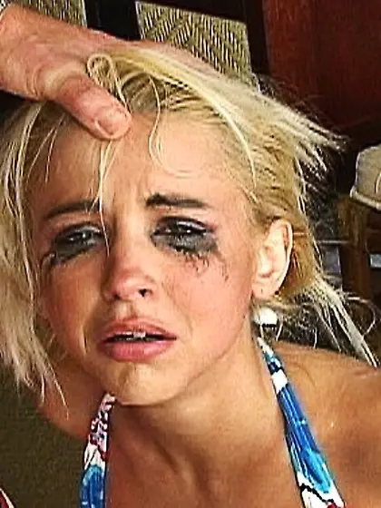 Misogyny is a cure for female hysteria