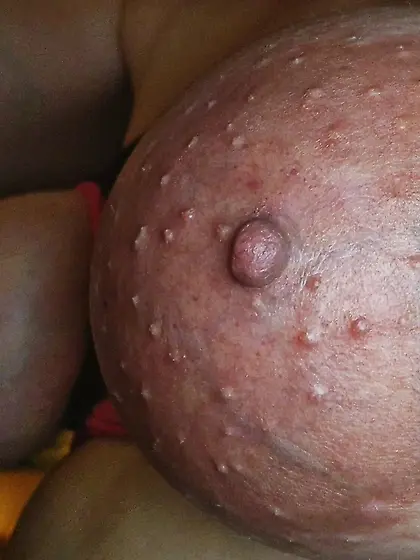 Meine Brueste,  Bubi,  Titten