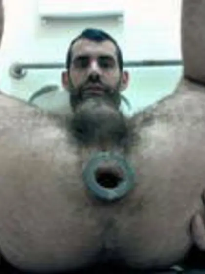 Hairy plugged hole
