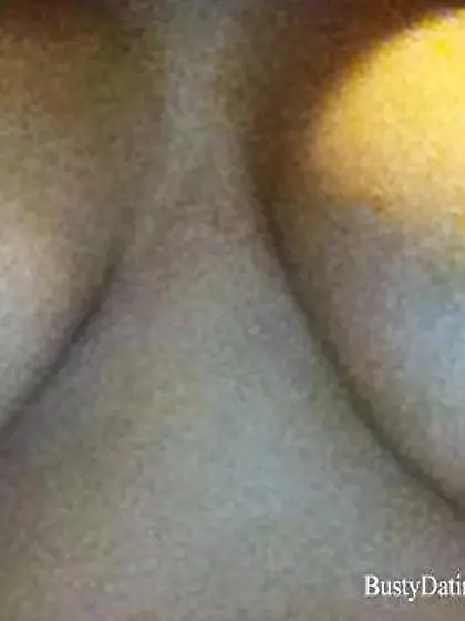 Busty Breast Reductions - Set 05