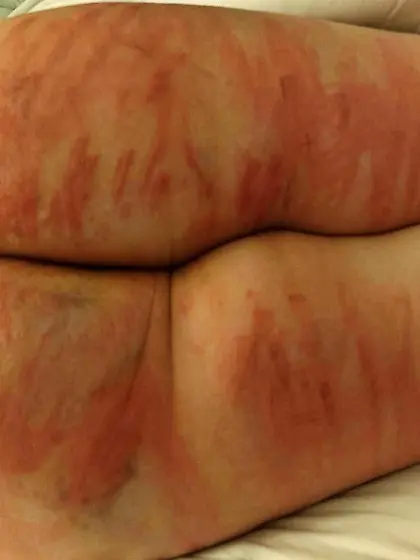 Misogyny is a cure for female hysteria