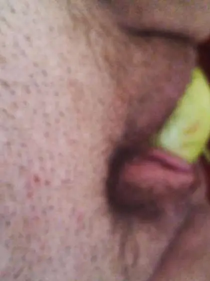 Wild injection