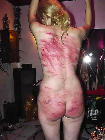 Misogyny is a cure for female hysteria