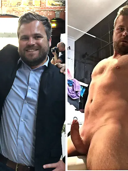 Before and after boy