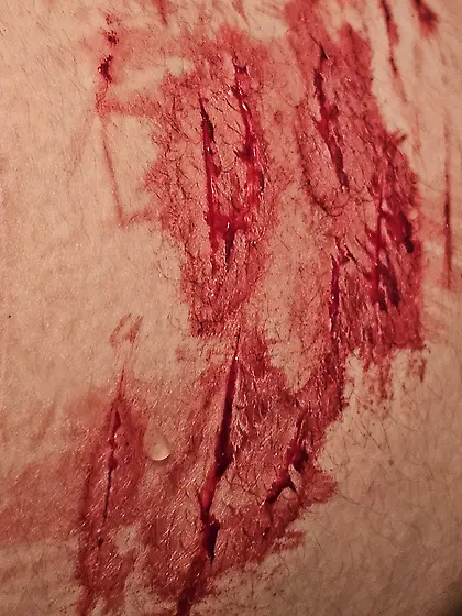Bloody cuts