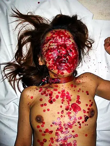 Misogyny is a cure for female hysteria