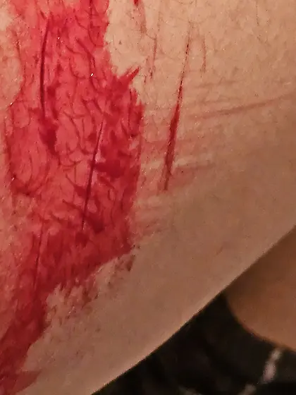 Bloody cuts