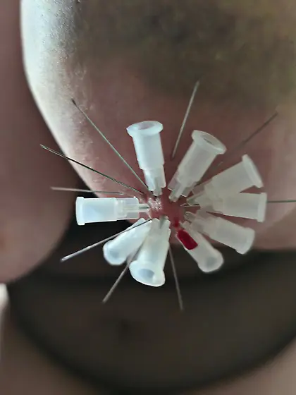 Brüste mit zehn Nadeln