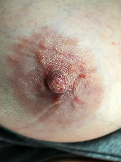 Nursing bra holding my 73 year old tits