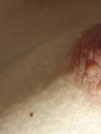 Small Empty Saggy Tits 2