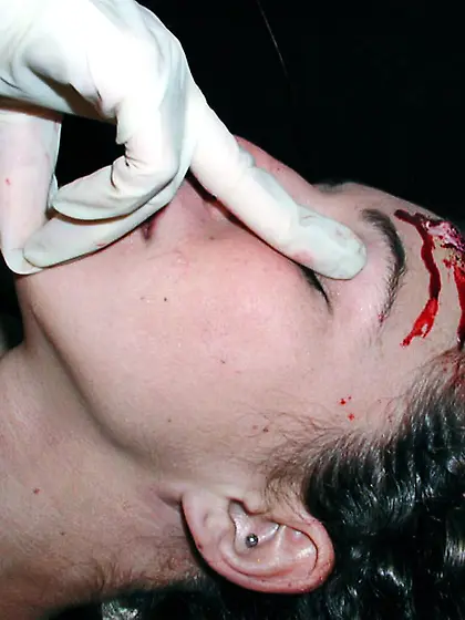 n6157 - Case-0C164E2 - Ember,  Mena