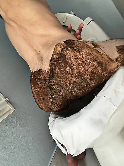 I poop on myself upside down and smear on my ass