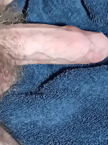 Hairy penis