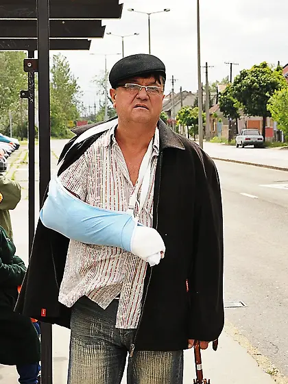 Eddie broke his arm