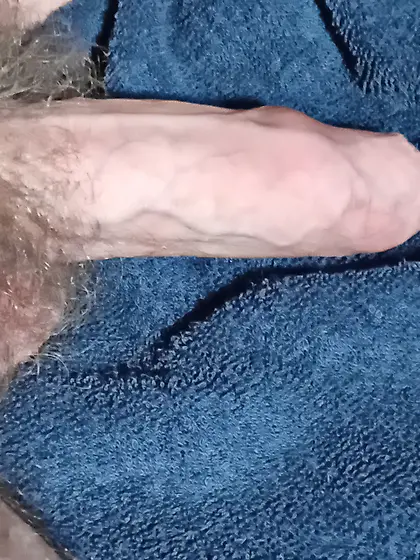 Hairy penis