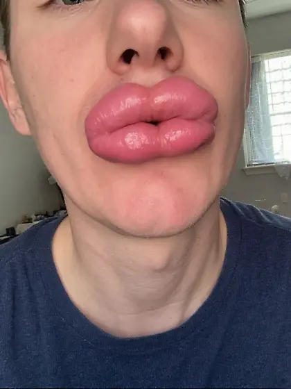 lips