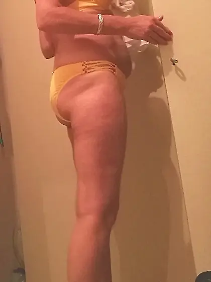 Mijn Borstprotheses Prothese BH's Amsterdam