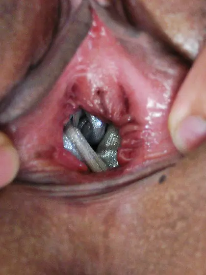 Fetishistic girl fucking her pussy with a high heeled shoe to or