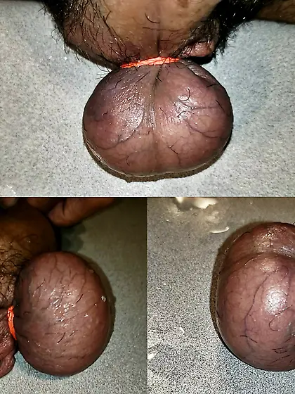 $500 to have my balls remove