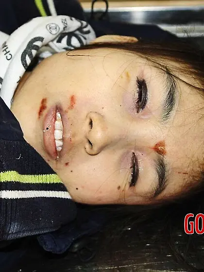 Belle femme morte en doudoune