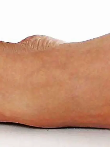 Biathlon starlet Magdalena Neuner lovely soles