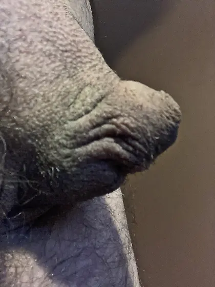 Small virgin cock and balls