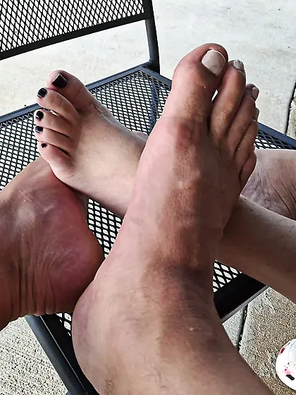 Foot comparison
