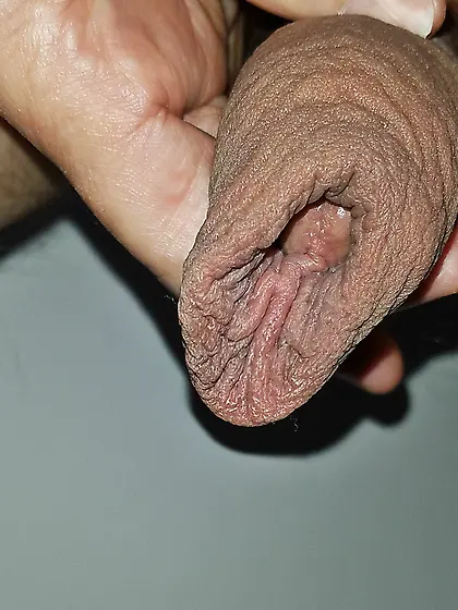 XXL foreskin to be filled with a cock or a big gla