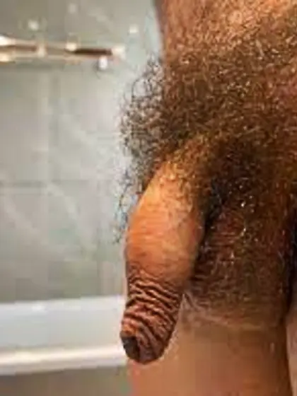 Extra skin in the game