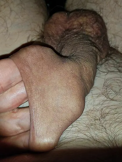 XXL foreskin to be filled with a cock or a big gla