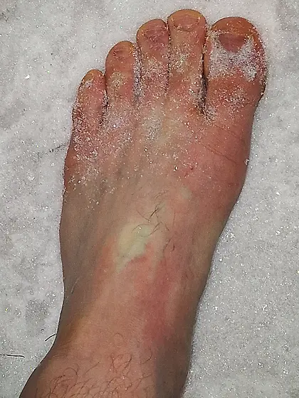 My feet on snow.  Temperature -20°C.