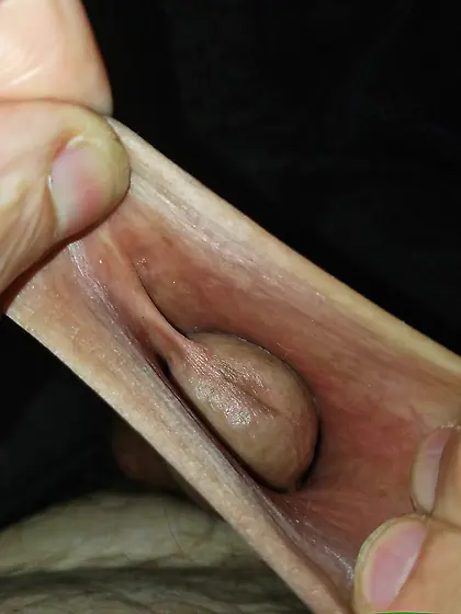 XXL foreskin to be filled with a cock or a big gla