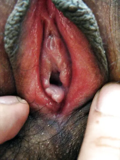 big pussy lips