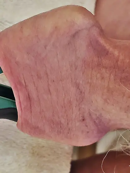 Foreskin Torture and Stretch