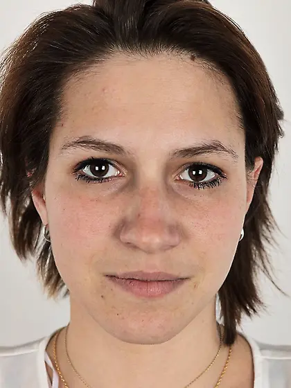 European breast amateur